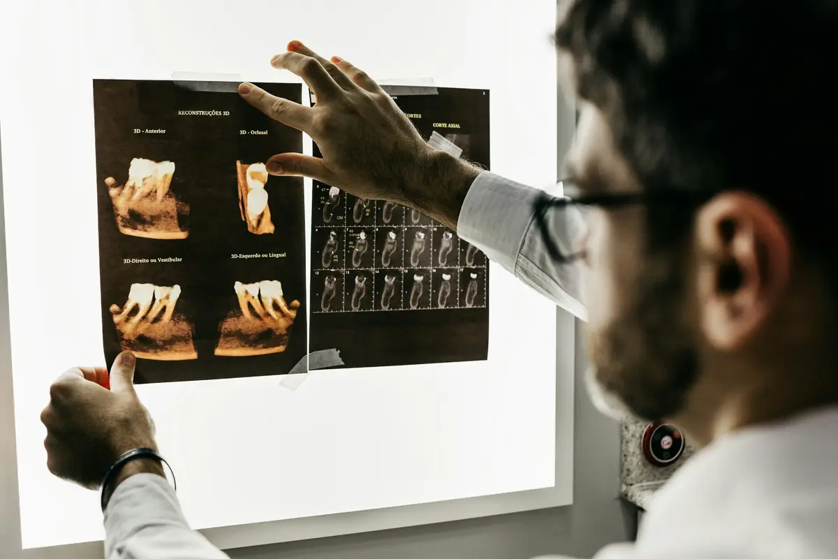 A dentist looking at x-rays on a light box