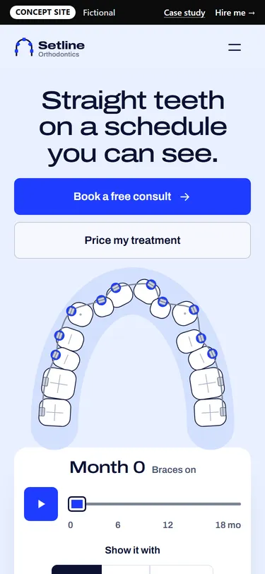 Setline Orthodontics home page on a phone